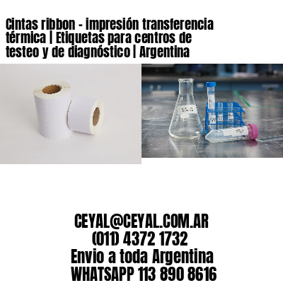 Cintas ribbon – impresión transferencia térmica | Etiquetas para centros de testeo y de diagnóstico | Argentina