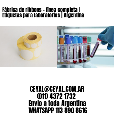 Fábrica de ribbons – línea completa | Etiquetas para laboratorios | Argentina